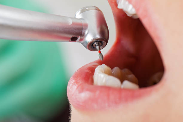 Best Same-Day Emergency Dental Services in Amelia Court House, VA